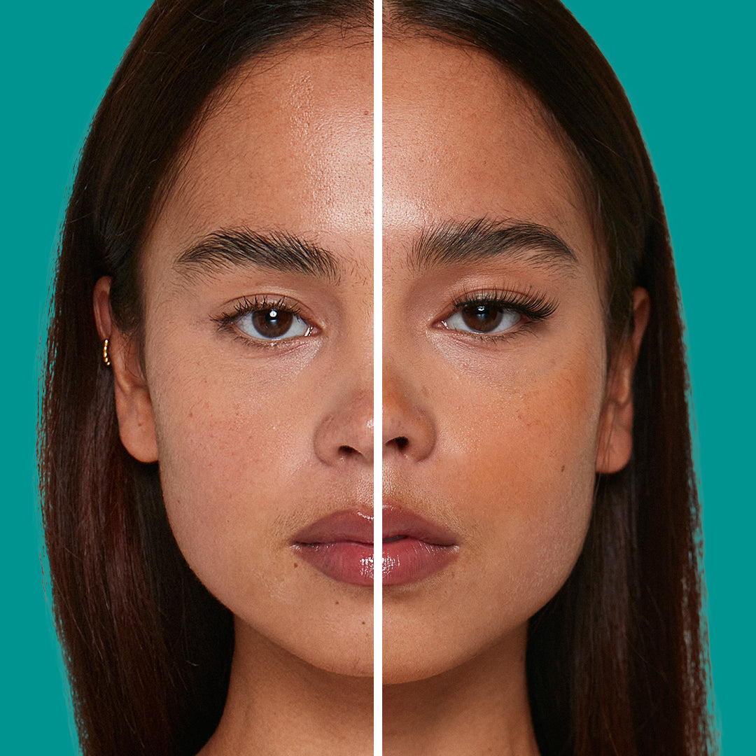 EE_Before_After_Natural02.jpg