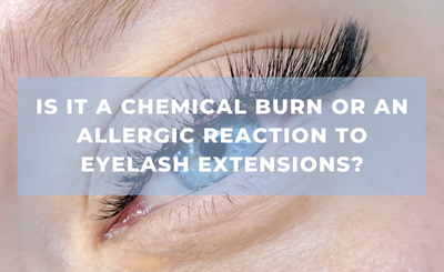Is It a Chemical Burn or an Allergic Reaction to Eyelash Extensions?